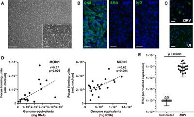 Zika Virus Infection of Human Iris Pigment Epithelial Cells